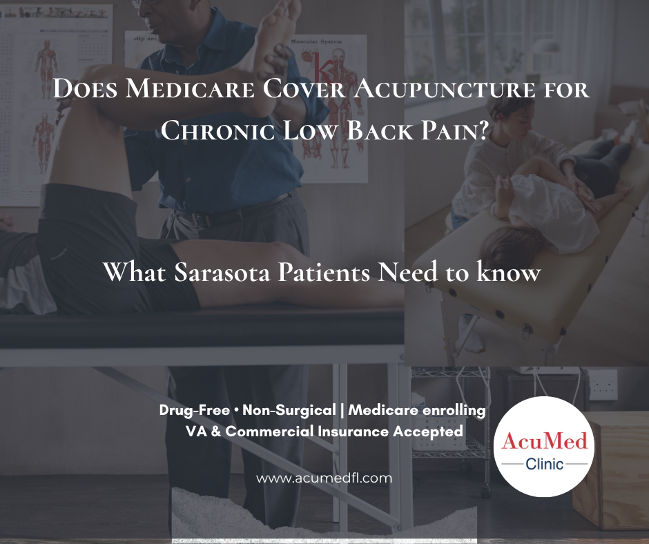 Does Medicare Cover Acupuncture for Chronic Low Back Pain?