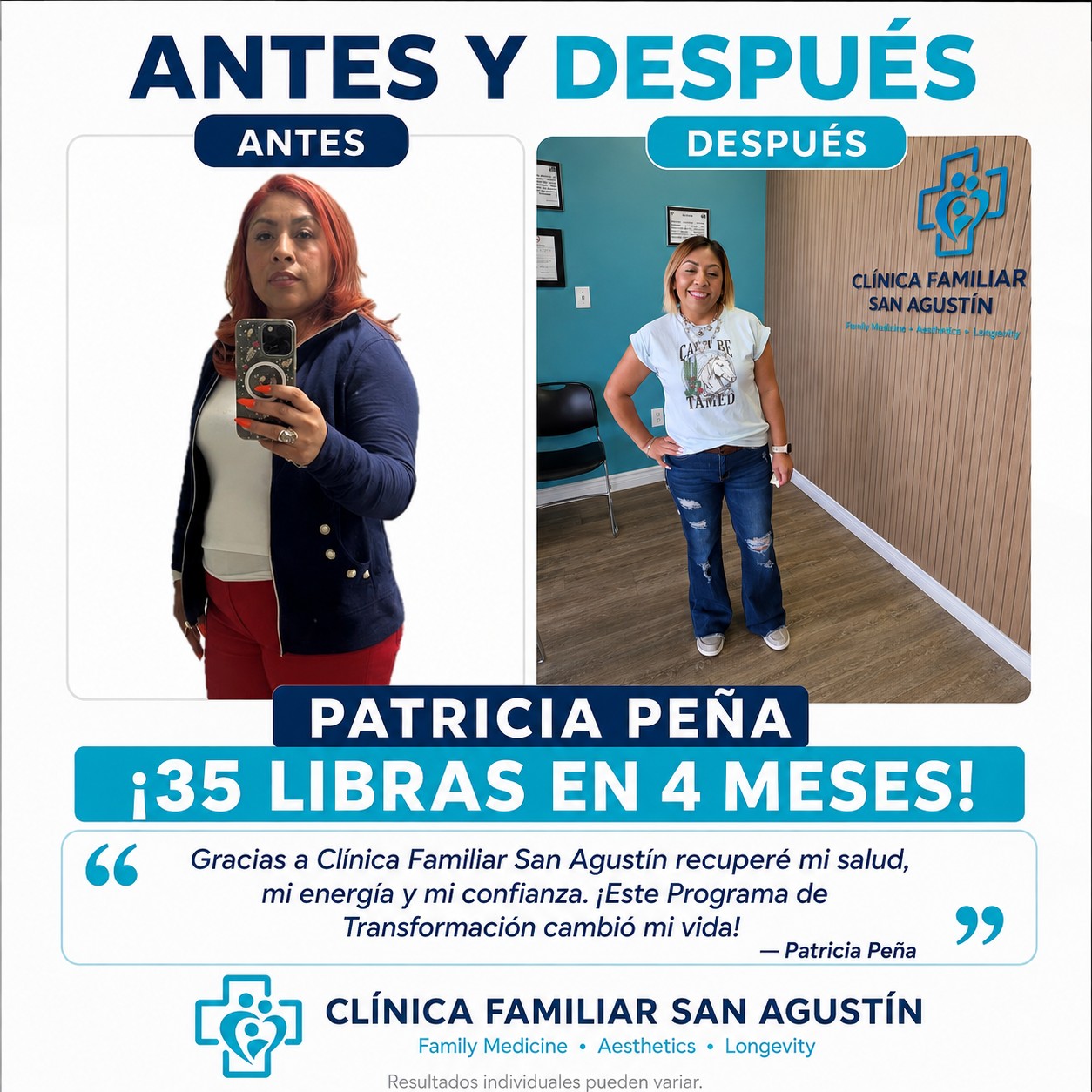 Antes y después — Patricia Peña