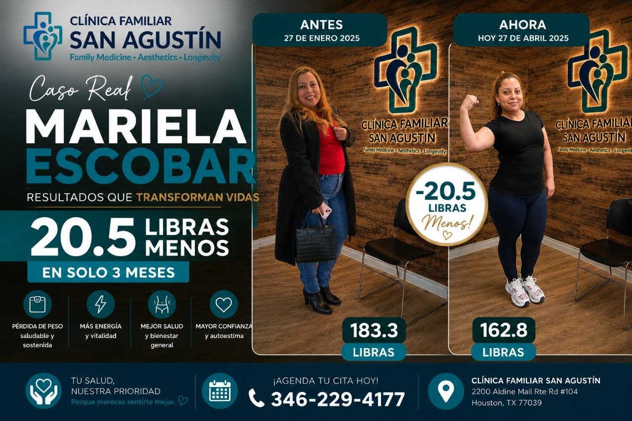 Antes y después — Mariela Escobar