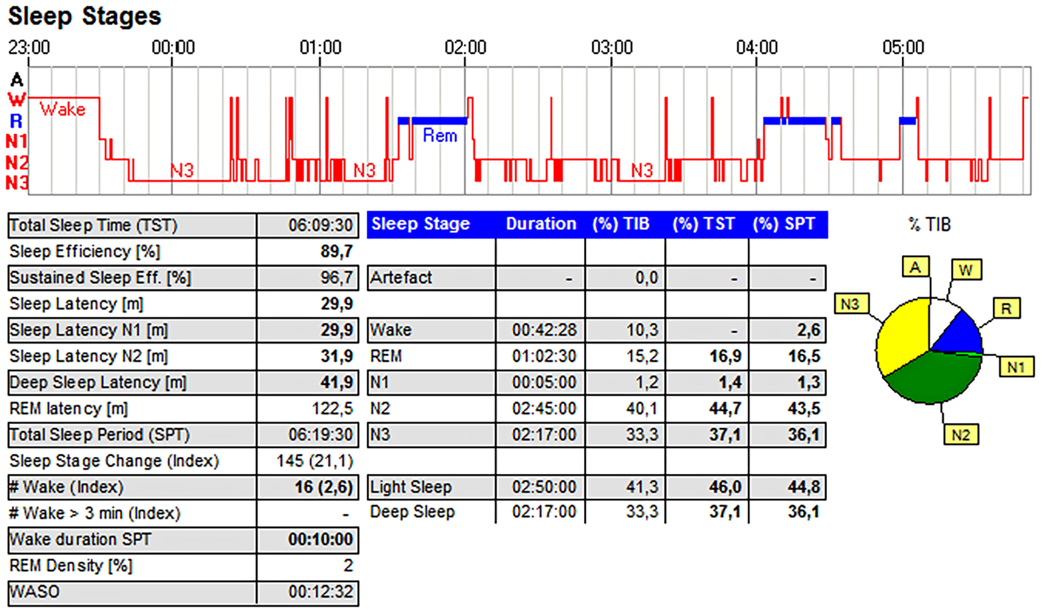 DOMINO Sleep Stages analysis with hypnogram, sleep architecture, and stage distribution