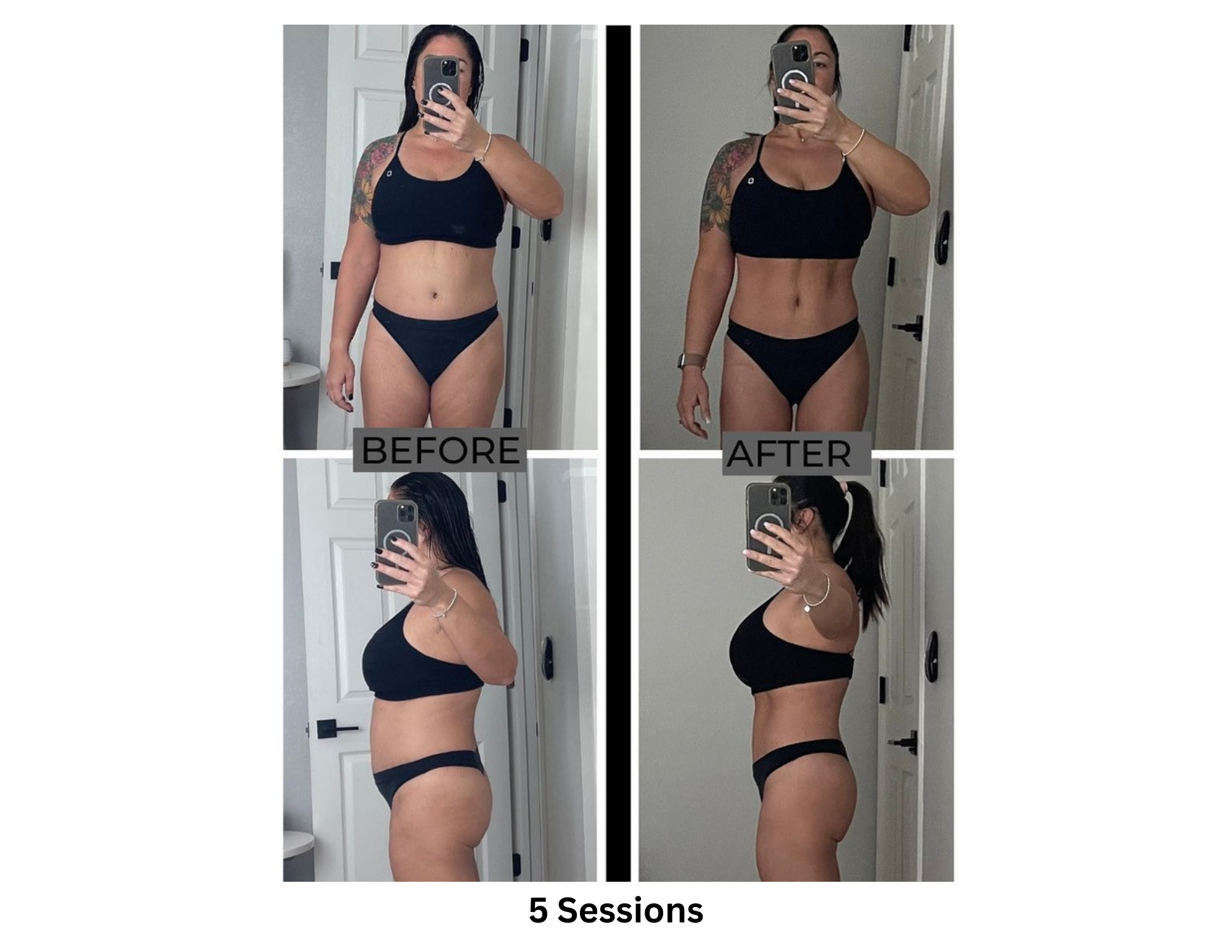 Cryotherapy before and after 5 sessions