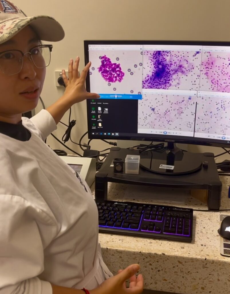 Researcher demonstrating the digital pathology platform used for cancer cell analysis