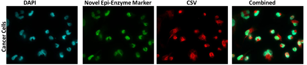Cancer cell markers: DAPI, Novel Epi-Enzyme Marker, CSV, and Combined imaging