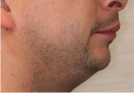 Comprehensive surgical – Patient 6 before