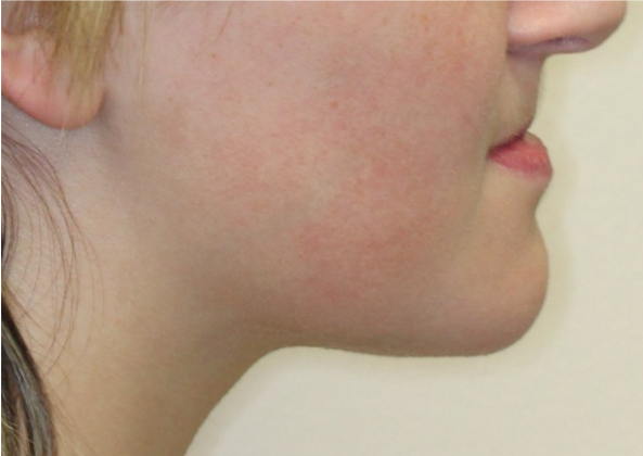 Comprehensive surgical – Patient 7 before