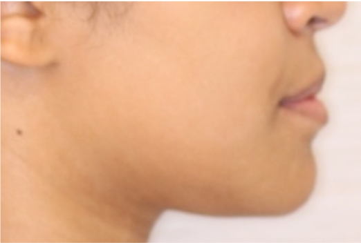 Comprehensive surgical – Patient 5 after