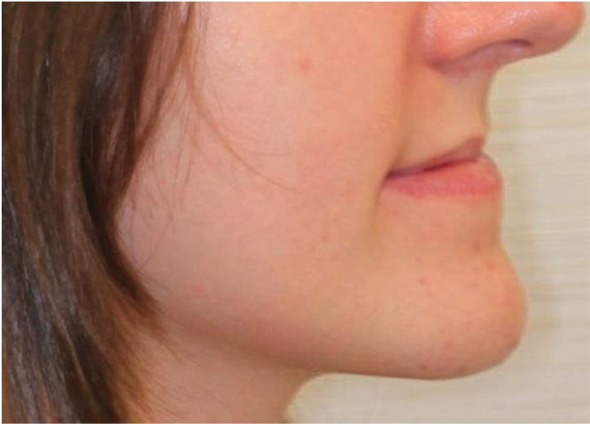 Comprehensive surgical – Patient 3 before