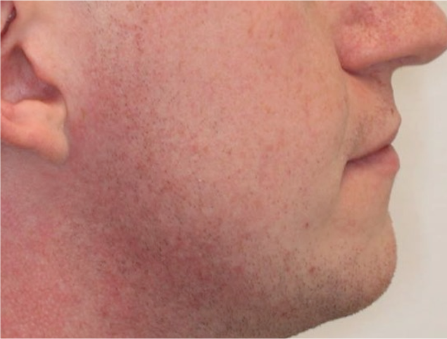 Comprehensive surgical – Patient 4 after