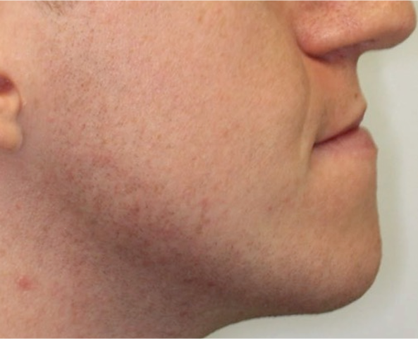 Comprehensive surgical – Patient 4 before