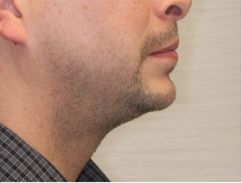 Comprehensive surgical – Patient 6 after