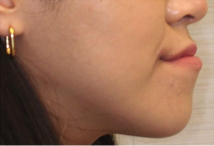 Comprehensive surgical – Patient 2 before