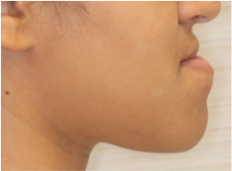Comprehensive surgical – Patient 5 before