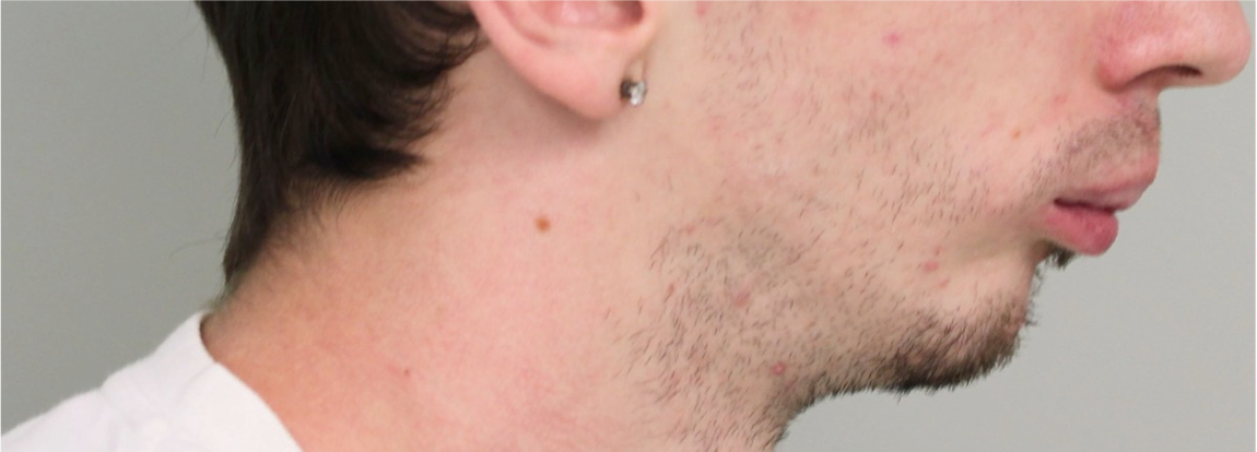 Comprehensive surgical – Patient 1 before