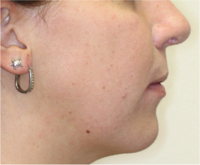 Comprehensive surgical – Patient 8 after