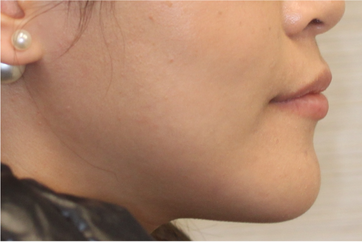 Comprehensive surgical – Patient 2 after