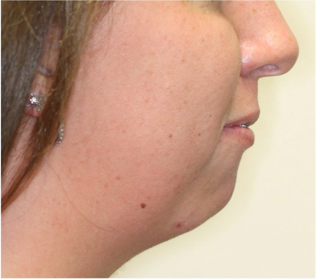 Comprehensive surgical – Patient 8 before