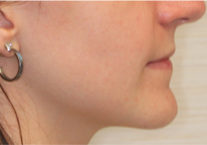 Comprehensive surgical – Patient 3 after